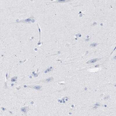 Immunohistochemistry-Paraffin: TSGA2 Antibody [NBP1-89839]