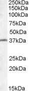 Western Blot: TSGA2 Antibody [NBP1-20992]