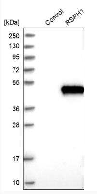 Western Blot: TSGA2 Antibody [NBP1-89840]