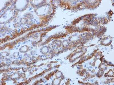 Immunohistochemistry-Paraffin: TSHR Antibody (SPM222) - Azide and BSA Free [NBP2-54317]