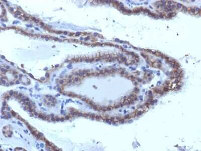 Immunohistochemistry-Paraffin: TSHR Antibody (SPM223) - Azide and BSA Free [NBP2-54569]