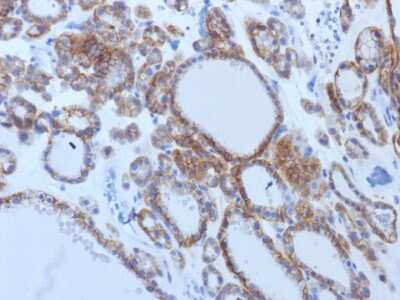 Immunohistochemistry-Paraffin: TSHR Antibody (TSHRB/1405) - Azide and BSA Free [NBP2-54322]