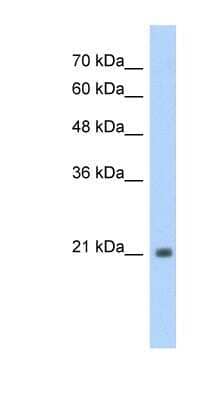 Western Blot: TSHR Antibody [NBP1-53167]