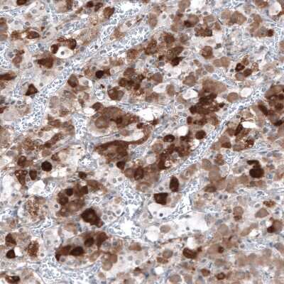 Immunohistochemistry-Paraffin: TSH beta Antibody [NBP2-68647]