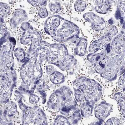 Immunohistochemistry-Paraffin: TSH beta Antibody [NBP2-68647]