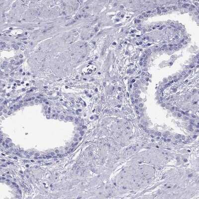 Immunohistochemistry-Paraffin: TSH beta Antibody [NBP2-68647]