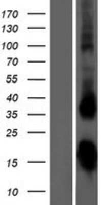 Western Blot: TSH beta Overexpression Lysate [NBP2-10682]