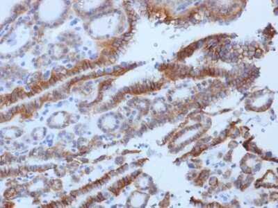 Immunohistochemistry-Paraffin: TSHR Antibody (SPM222) [NBP2-53224]