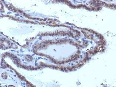 Immunohistochemistry-Paraffin: TSHR Antibody (SPM223) [NBP2-53217]