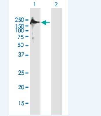 Western Blot: TSHZ2 Antibody [H00128553-B01P-50ug]