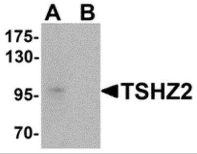 Western Blot: TSHZ2 AntibodyBSA Free [NBP2-82041]