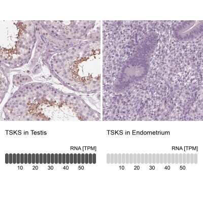 Immunohistochemistry-Paraffin: TSKS Antibody [NBP1-92539]