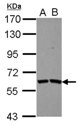 Western Blot: TSKS Antibody [NBP2-20749]