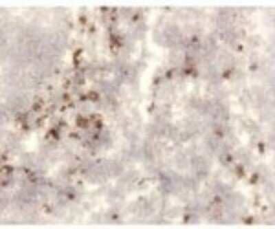 Immunohistochemistry: TSLP Antibody (209A2.03) [DDX0801P-100]