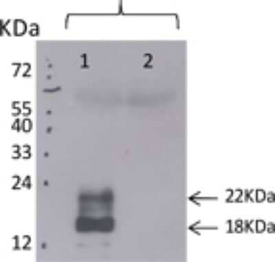 Western Blot: TSLP Antibody (210H1) [DDX0804P-100]