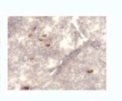 Immunohistochemistry: TSLP Antibody (214E4.01) [DDX0800P-100]