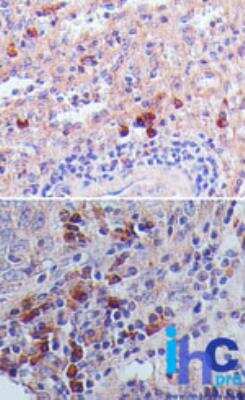 Immunohistochemistry-Paraffin: TSLP Antibody (55N1D10) - BSA Free [NBP2-27326]