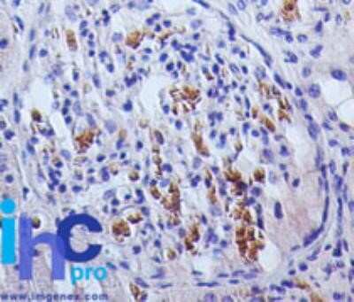 Immunohistochemistry: TSLP Antibody (55N2D4) - Azide and BSA Free [NBP2-80998]