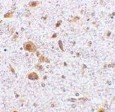 Immunohistochemistry-Paraffin: TSLP Antibody - BSA Free [NBP1-76754]