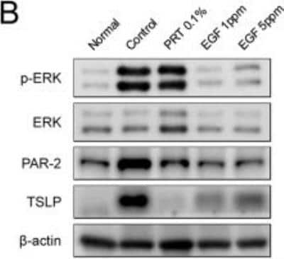 Western Blot: TSLP AntibodyBSA Free [NB110-55234]