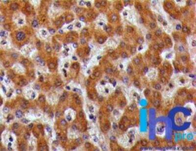 Immunohistochemistry-Paraffin: TSLPR/CRLF2 Antibody [NBP2-22383]