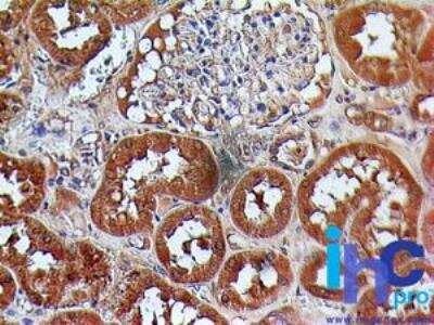 Immunohistochemistry-Paraffin: TSLPR/CRLF2 Antibody [NBP2-22384]