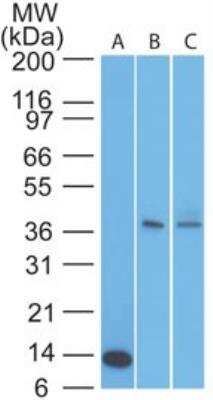 Western Blot: TSLPR/CRLF2 Antibody [NBP2-22383]