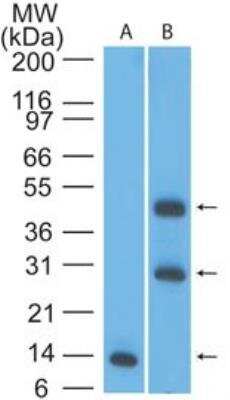 Western Blot: TSLPR/CRLF2 Antibody [NBP2-22384]