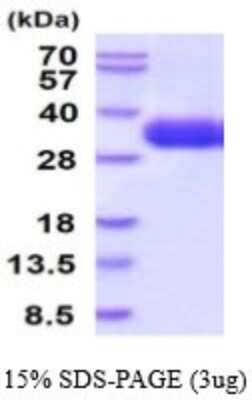 SDS-PAGE: Recombinant Human TSLPR/CRLF2 His Protein [NBP2-53075]