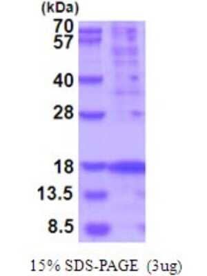 SDS-PAGE: Recombinant Human TSLP His Protein [NBP2-51957]