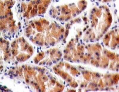 Immunohistochemistry-Paraffin: TSLPR/CRLF2 Antibody (59N5G4) - Azide and BSA Free [NBP2-81000]
