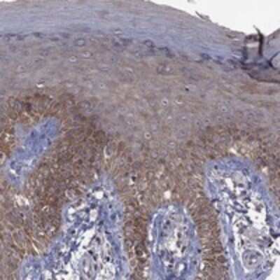 Immunohistochemistry-Paraffin: TSNARE1 Antibody [NBP3-17015]