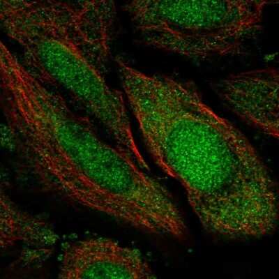 Immunocytochemistry/ Immunofluorescence: TSNAXIP1 Antibody [NBP2-58035]