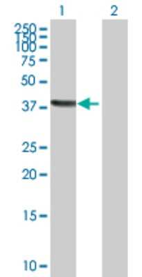 Western Blot: TSNAXIP1 Antibody [H00055815-B01P]