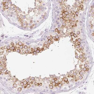 Immunohistochemistry-Paraffin: TSP50 Antibody [NBP2-34204]