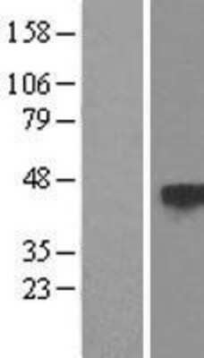 Western Blot: TSP50 Overexpression Lysate [NBL1-17365]