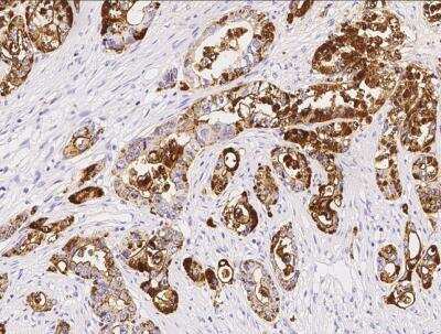 Immunohistochemistry-Paraffin: TSPAN1 Antibody (010) [NBP2-90167]