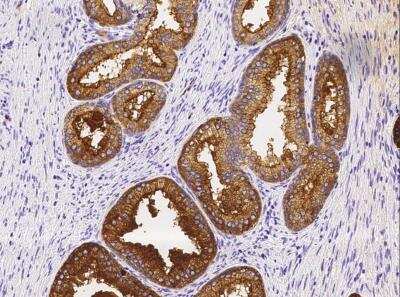 Immunohistochemistry-Paraffin: TSPAN1 Antibody (010) [NBP2-90167]