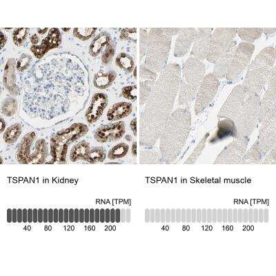 Immunohistochemistry-Paraffin: TSPAN1 Antibody [NBP2-33867]