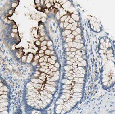 Immunohistochemistry-Paraffin: TSPAN1 Antibody [NBP2-33867]