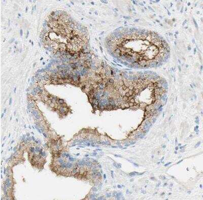 Immunohistochemistry-Paraffin: TSPAN1 Antibody [NBP2-33867]