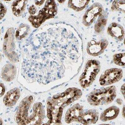 Immunohistochemistry-Paraffin: TSPAN1 Antibody [NBP2-33867]