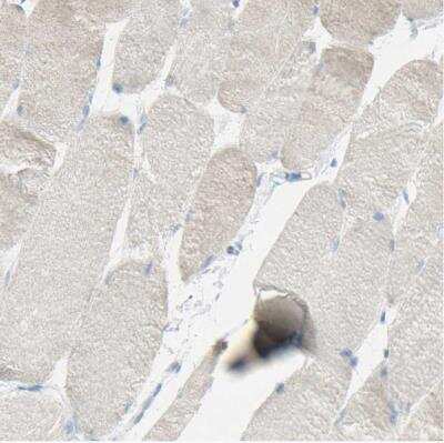Immunohistochemistry-Paraffin: TSPAN1 Antibody [NBP2-33867]