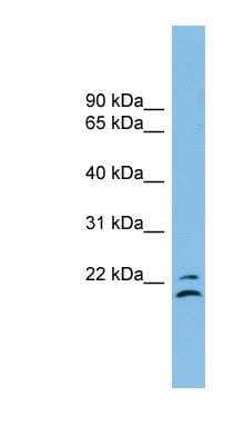 Western Blot: TSPAN1 Antibody [NBP1-54405]