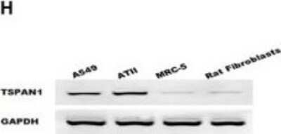 Western Blot: TSPAN1 Antibody [NBP2-33867]