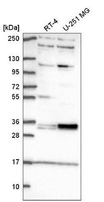 Western Blot: TSPAN11 Antibody [NBP2-57481]