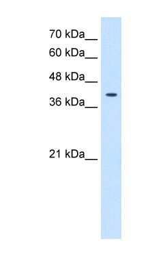 Western Blot: TSPAN12 Antibody [NBP1-91297]