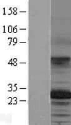 Western Blot: TSPAN12 Overexpression Lysate [NBP2-04335]