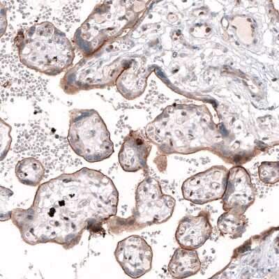 Immunohistochemistry-Paraffin: TSPAN13 Antibody [NBP1-81001]