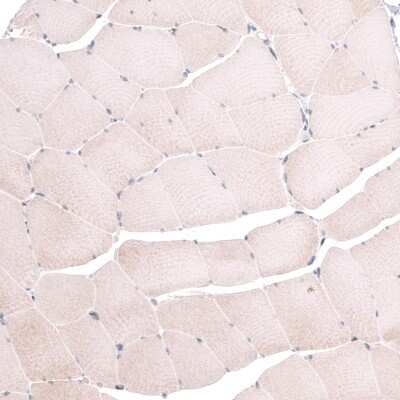 Immunohistochemistry-Paraffin: TSPAN13 Antibody [NBP1-81001]